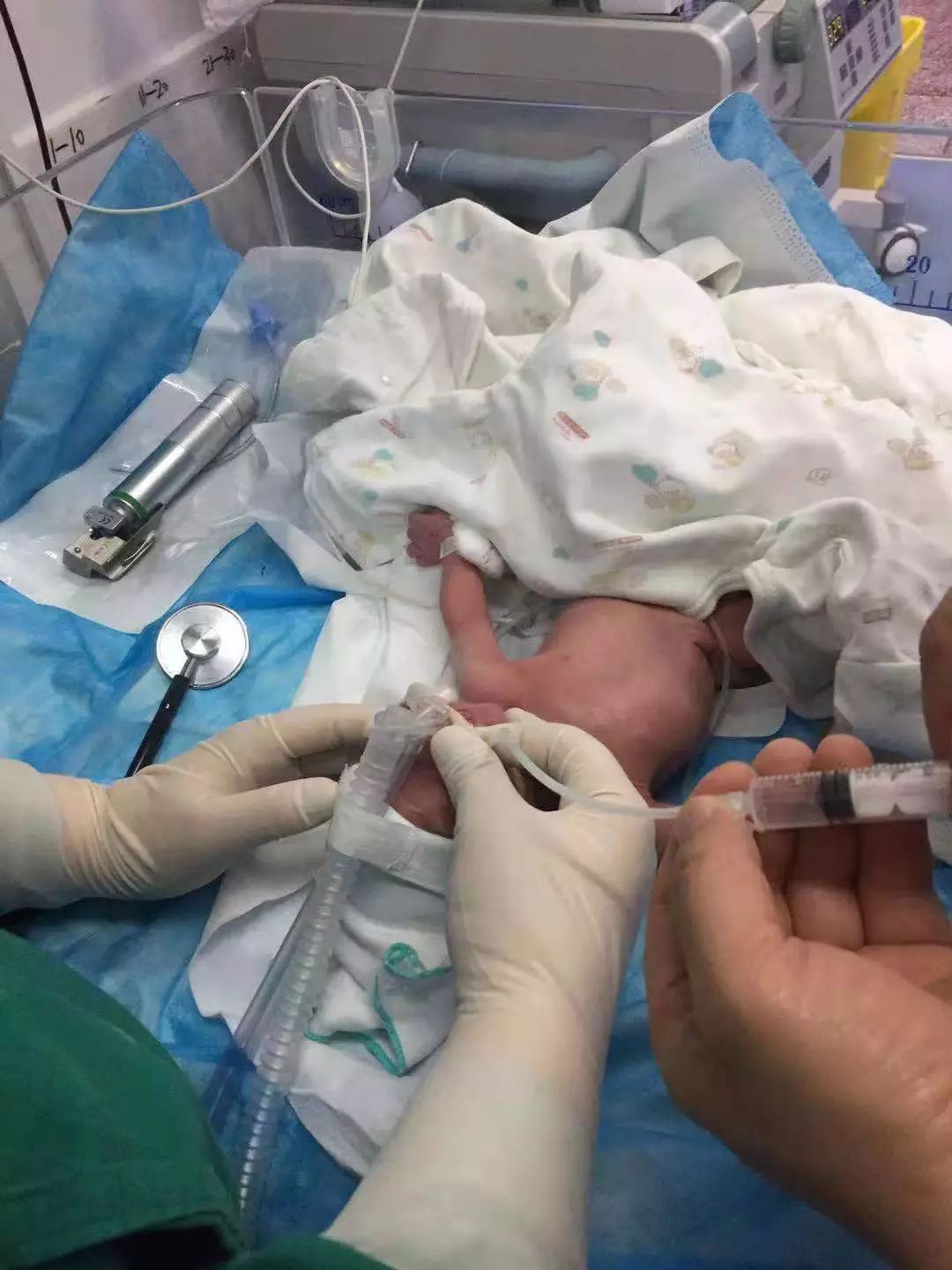 铜仁市妇幼保健院新生儿科同时开展LISA和PICC置管两项新技术