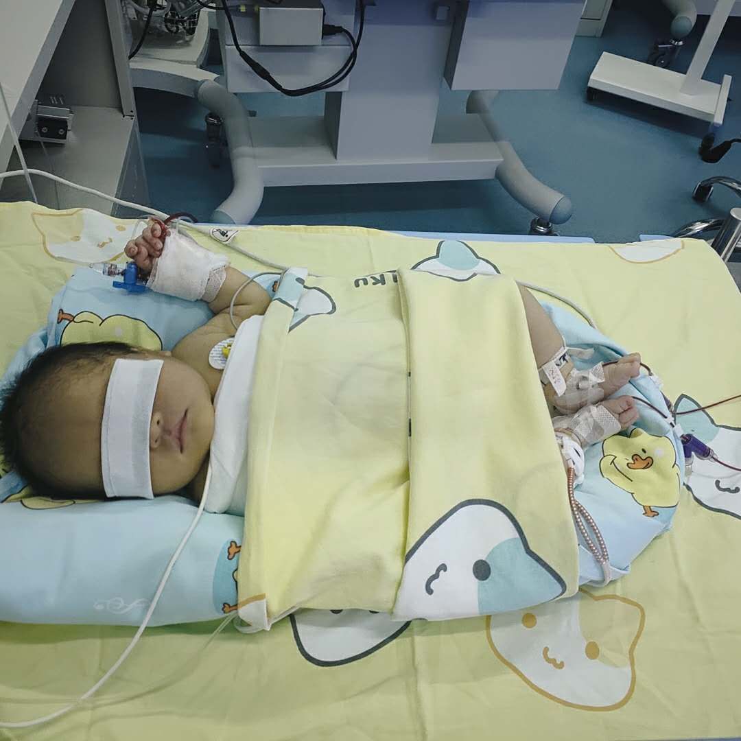 我院开展动静脉同步换血术，抢救一例极重度高胆红血素症新生儿