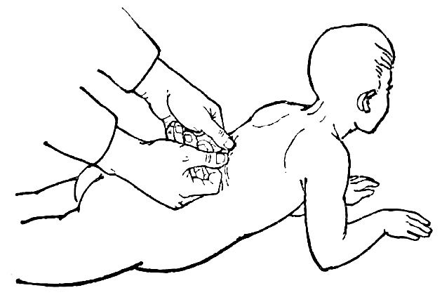 0-3岁儿童中医管理健康知识宣传知识
