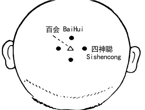0-3岁儿童中医管理健康知识宣传知识