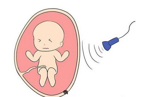 B超检查对胎儿是否有危害？
