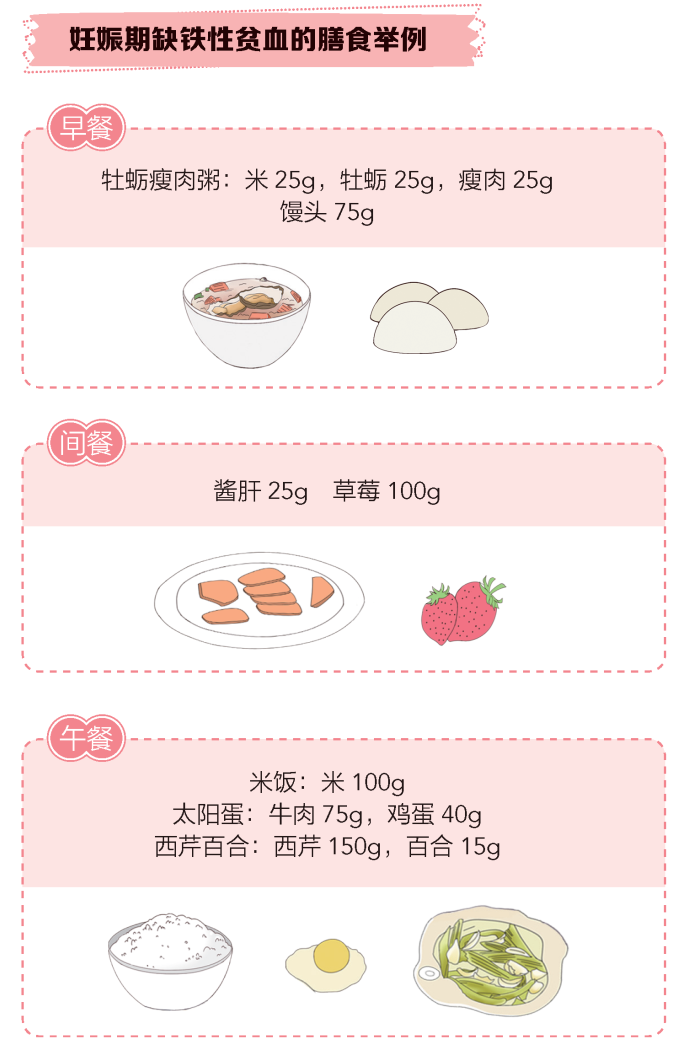 【科普】缺铁性贫血：孕期不可忽视的一个问题