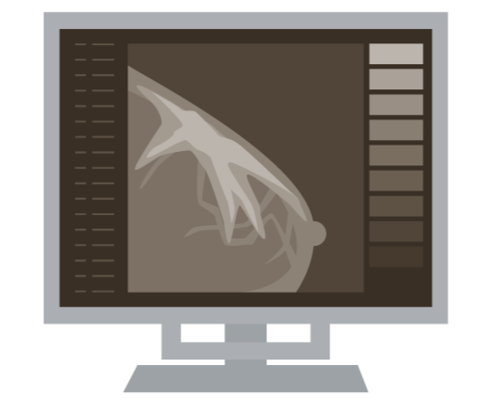 【科普】姐妹，乳腺癌偏爱哪类人？科学预防乳腺癌，这些事你要知道！