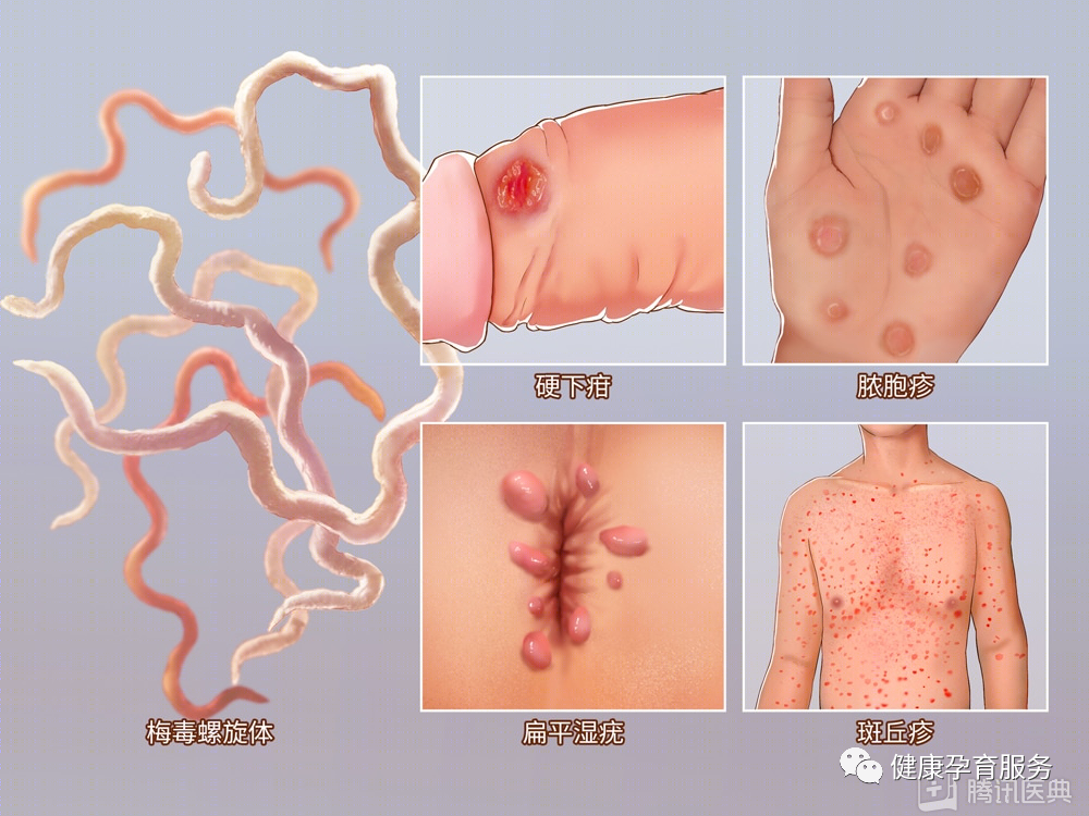 【科普】结婚前，请一定要做婚检！建议扩转收藏！