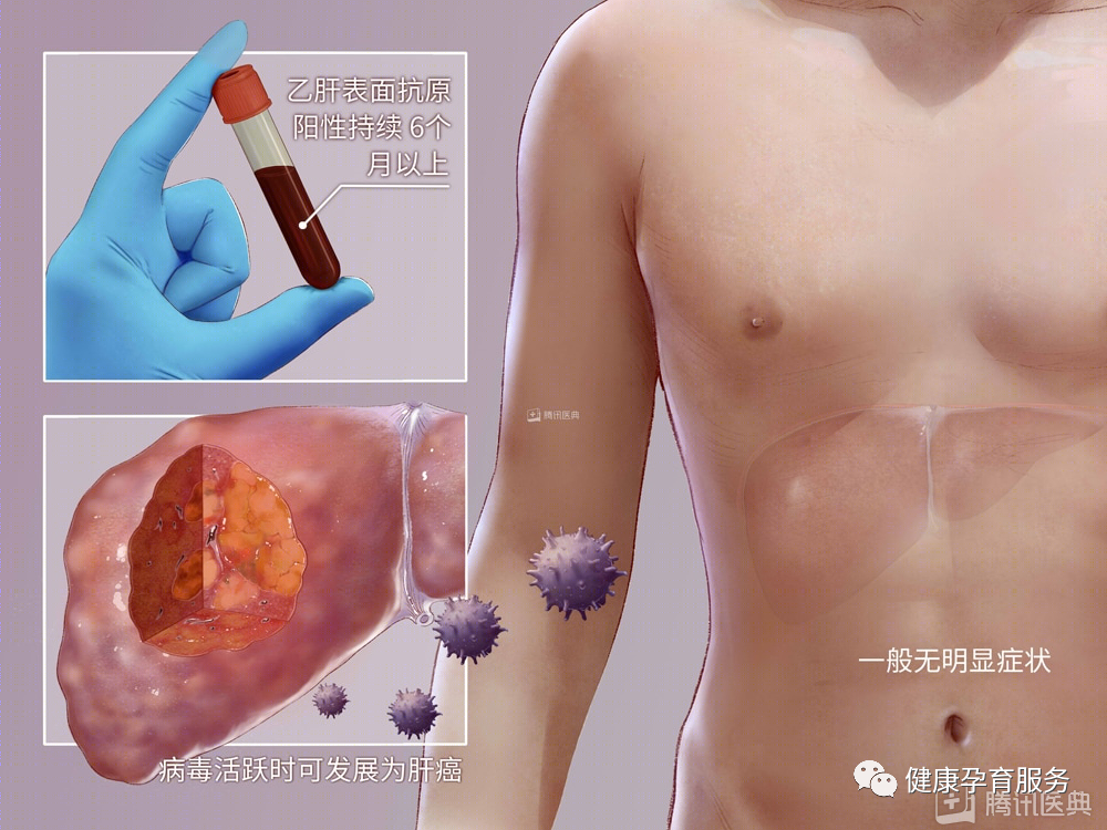 【科普】结婚前，请一定要做婚检！建议扩转收藏！