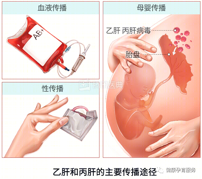 【科普】结婚前，请一定要做婚检！建议扩转收藏！