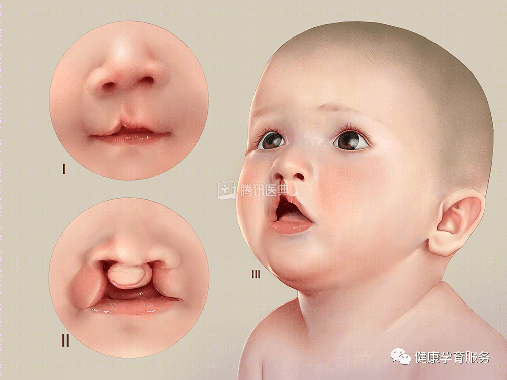 【科普】结婚前，请一定要做婚检！建议扩转收藏！